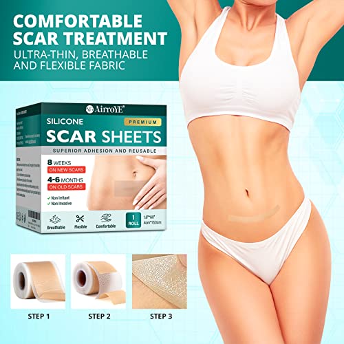 Silicone Scar Sheets, 1.6"x 120" Roll P68749