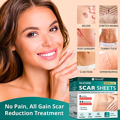 Silicone Scar Sheets, 1.6"x 120" Roll P68749