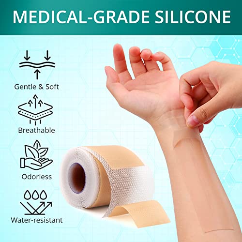Silicone Scar Sheets, 1.6"x 120" Roll P68749